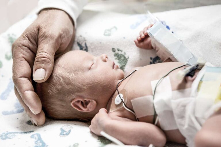 What should we expect if our baby’s in the NICU?