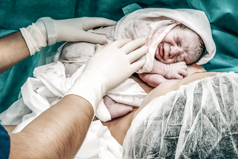 Answering 6 Questions You May Have About C-Sections